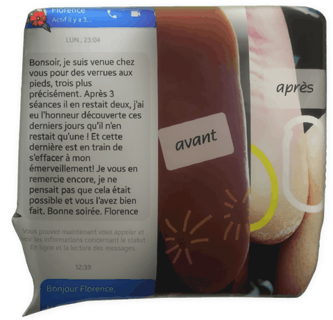 témoignage magnétiseur magnétisme verrue plantaire Florence O. L. Pont-Aven